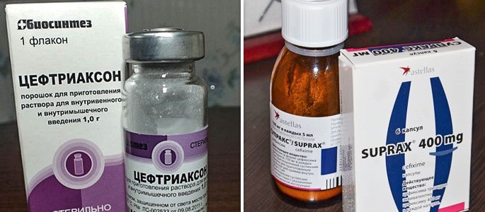 antibiotikipriotiteudeteyivzroslixvazhni DBD92F58 - Эффективное лечение отита у взрослых антибиотиками