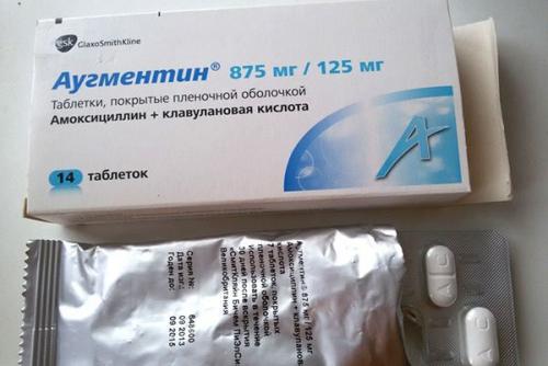 antibiotikipriotiteuvzroslixlechenievidi 49CE562B - Эффективное лечение отита у взрослых антибиотиками