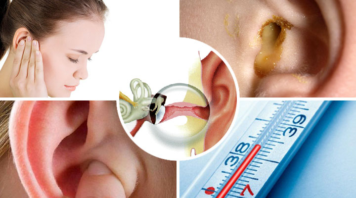 diffuzniyotitnaruzhnogouxasimptomiileche 36B607C1 - Диффузный отит наружного уха — симптомы и лечение