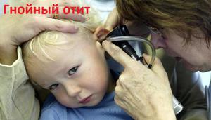 doktorkomarovskiyoraznovidnostyaxotitaur 205FC10B - Отит у ребенка: лечение доктора Комаровского