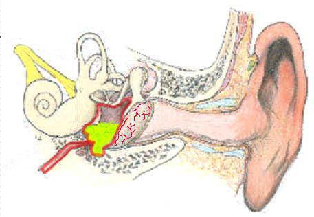 ekssudativniyotitudeteyivzroslixlechenie 33D922EB - Корочки в ушах, сухие уши и шелушение ушей: причины и методы избавления