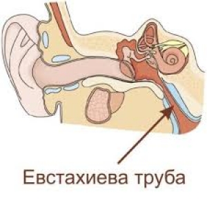 evstaxiitsimptomiilechenieudeteyivzrosli 1640B9D2 - Лечение тубоотита и евстахиита в домашних условиях народными средствами