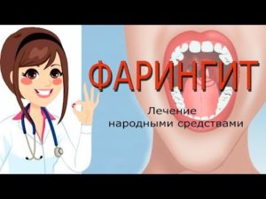 faringitkaklechituvzroslogoxronicheskiyf B601DF4F - Лечение фарингита народными средствами в домашних условиях