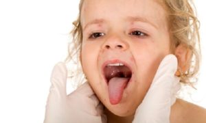 gerpeticheskiyfaringitgerpesniyudeteyivz 293F9895 - Ушные капли при отите: какие лучше капли в уши при отите для детей и взрослых
