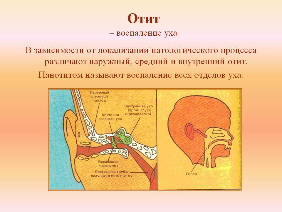 kaklechitotituxavdomashnixusloviyaxbolee A1223C63 - Как лечить воспаление уха в домашних условиях: народные методы и медикаментозные препараты при отите