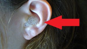 kakubratsernuyuprobkuvdomashnixusloviyax 3ED46B3E - Основные причины образования пробок в ушах, как убрать