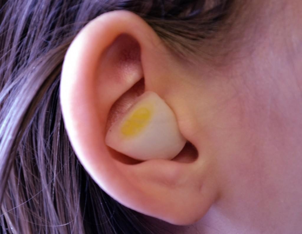 kakvosstanovitsluxposleotitapriotitesniz 84854E30 - Как восстановить слух после отита: официальная медицина, упражнения для слуха, массаж