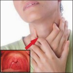 komvgorleprifaringitelechenieoshusheniya 851A4EE6 - Отечность небного язычка в горле (увулит): причины, из-за чего он может увеличиваться, симптомы и лечение