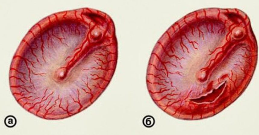 krovizuxapriotiteurebenkaivzroslixscheme 35FB1077 - Кровь из уха — причины и лечение кровотечений ушей