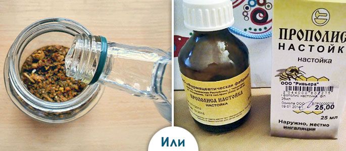 lecheniefaringitanarodnimisredstvamiuvzr BA8B52DB - Лечение фарингита народными средствами у взрослых
