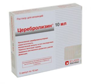 lecheniesluxasensonevralnayatugouxost14s 2DCEA404 - Сенсоневральная тугоухость: степени, лечение
