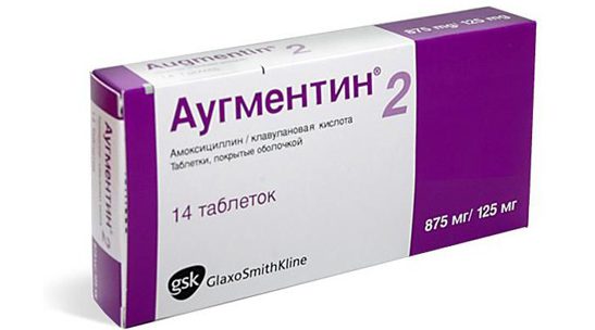 mastoiditxarakteristikasimptomilecheniep 49B2C1EC - Мастоидит: характеристика, симптомы, лечение, прогноз