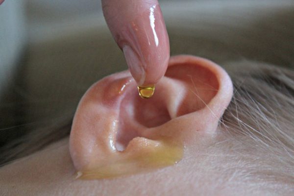 naruzhniyotitsimptomiilechenie B1337B26 - Наружный отит (отит наружного уха) у взрослого – причины, симптомы и лечение наружного отита