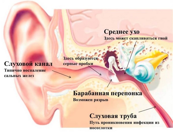 nevritsluxovogonervasimptomilechenieipri F4B6C32A - Неврит слухового нерва: симптомы и лечение воспаления