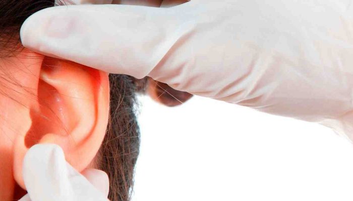 operatsiyanauxopriotite A385F0DD - Корочки в ушах, сухие уши и шелушение ушей: причины и методы избавления