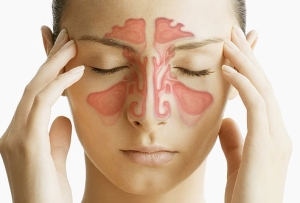ostriysinusitvidisimptomiilechenie E6E36364 - Острый синусит – инфекционное заболевание околоносовых воздушных полостей — пазух носа