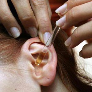 ostriysredniyotituxastadiividisimptomile 81EFA396 - Отит среднего уха: симптомы и лечение, фото