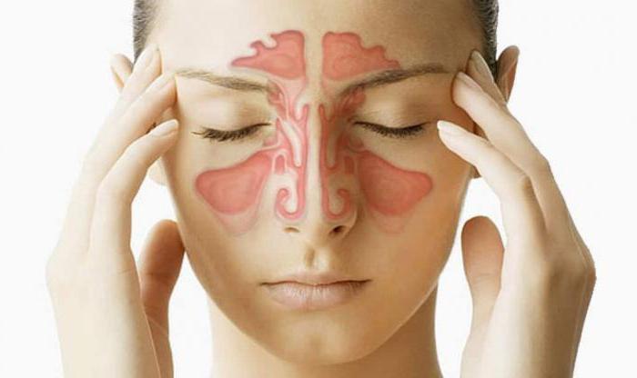 ostriyverxnechelyustnoysinusitosnovniesi DFC7D945 - Синдром Меньера относится к заболеваниям внутреннего уха