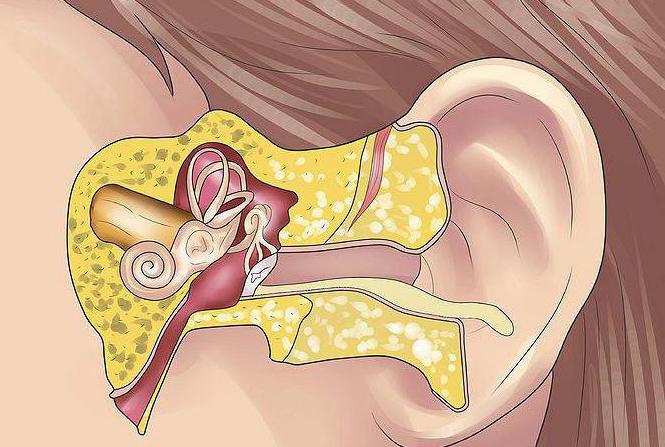 otitchtoetotakoexronicheskiyotitsimptomi 5E1C1789 - Хронический отит уха – симптомы и лечение у взрослых и детей