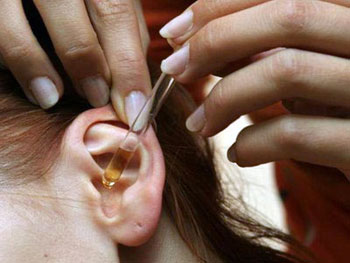 otitsimptomiilechenieuvzroslixpriznakiot 51176E85 - Ушные капли при отите: какие лучше капли в уши при отите для детей и взрослых