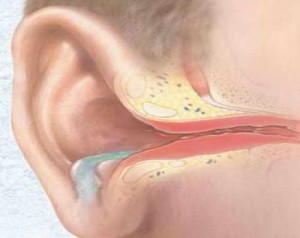 otitsimptomiilechenieuvzroslixpriznakiot 54F88C66 - Отит среднего уха — эта проблема может повлечь серьёзные осложнения