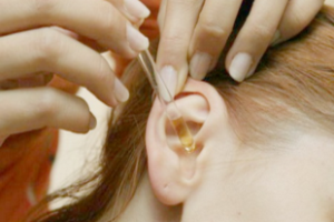 otitsrednegouxasimptomiilechenieuvzrosli 4C6EAAA1 - Отит среднего уха — эта проблема может повлечь серьёзные осложнения