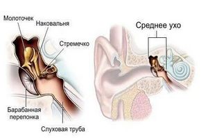 otitsrednegouxasimptomiilechenieuvzrosli 920EBE26 - Ушные капли при отите: какие лучше капли в уши при отите для детей и взрослых