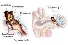 otituxaprichinividisimptomidiagnostikale EC601968 - Ушные капли при отите: какие лучше капли в уши при отите для детей и взрослых