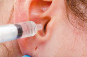 perekisvodorodapriotitevuxoprokolbaraban 9513982D - Перекись водорода при отите в ухо, прокол барабанной перепонки, лечение