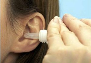 perekisvodorodapriotitevuxoprokolbaraban FAB6C7A2 - Корочки в ушах, сухие уши и шелушение ушей: причины и методы избавления