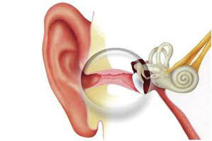 pervayapomoshpriotiteurebenkaiuvzroslogo E55578C4 - МКБ 10 — Кондуктивная и нейросенсорная потеря слуха (H90)