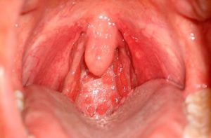 pochemunepriyatniyzapaxizortaprichiniile 506FC72D - Почему неприятный запах изо рта – причины и лечение