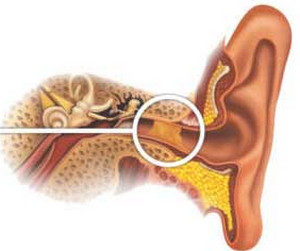 poslegrippazalozhilouxochtodelatlechenie 8A11224F - Осложнения на уши у взрослых после отита, гриппа или простуды: что делать, как лечить