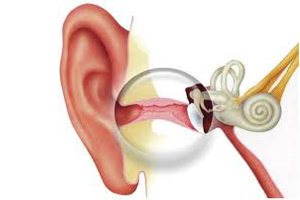 sredniyotitotitsrednegouxauvzroslixprich 3494664F - Отит среднего уха — эта проблема может повлечь серьёзные осложнения