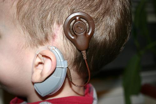 tugouxost2stepenilechenie F1029FDD - Лечение тугоухости – что делать для улучшения и восстановления слуха