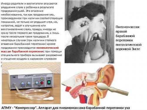 tugouxostlecheniesimptomikakvosstanoviti 686F1CC1 - Лечение тугоухости – что делать для улучшения и восстановления слуха