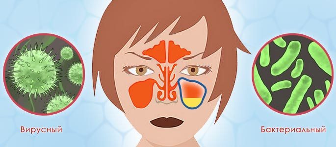 virusniyotitkakproyavlyaetsyainfektsionn F2EE06A4 - Болит ухо после орви: что делать