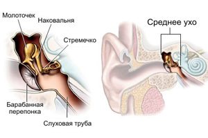 vospaleniesrednegouxauvzroslixprichinisi 2766B909 - Почему закладывает уши: причины и симптомы заложенности ушей, способы лечения в домашних условиях