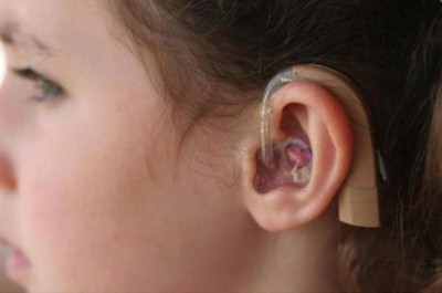 vosstanovleniesluxaposleotita 98CAAD2F - Как восстановить слух после отита: официальная медицина, упражнения для слуха, массаж