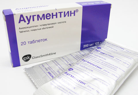 xronicheskiybronxitsimptomi 1B30FAA6 - Хронический бронхит — диффузное воспаление слизистой оболочки бронхов