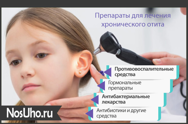 xronicheskiyotitlechenieisimptomiuvzrosl EB3D6A1D - Хронический отит уха – симптомы и лечение у взрослых и детей